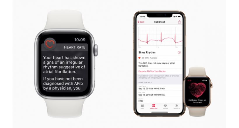 Aplicacion ecg para apple watch best sale